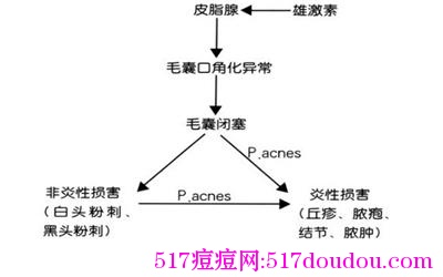 青春痘痘的类型有哪些？各种痘痘类型图片详解