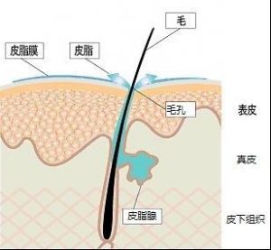 脂溢性脱发的注意事项