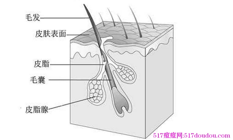 青春痘是怎么形成的？