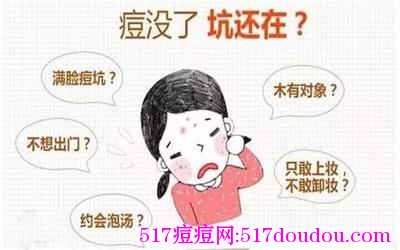 你属于这5种痘痕哪一种？