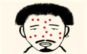 成人青春痘的原因有哪些?-健康吃瘦网