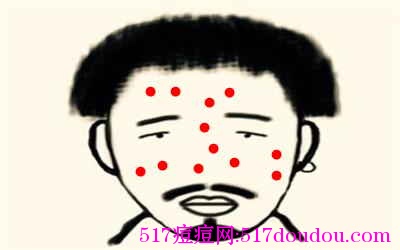 青春痘又叫什么？