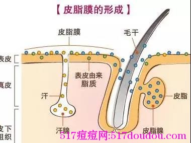 脸上长粉刺是什么原因？深度分析