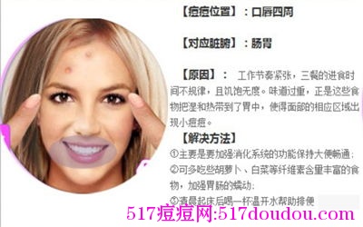 嘴周围长痘痘的原因有哪些?如何调理?