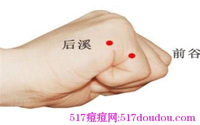 哪个穴位祛痘？祛痘穴位有哪些？