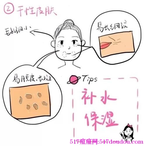 五大皮肤的分类图解（精华）