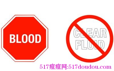 痘痘能挤吗？最正确方法是什么？