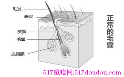 头上长痘痘是什么原因？