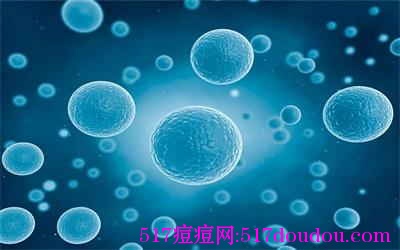 为什么脸上会长痤疮？