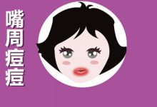 嘴唇周围长痘痘怎么治?-健康吃瘦网