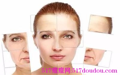 去粉刺最有效的方法！