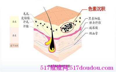 青春痘后遗症有哪些？