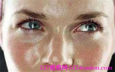 一张长痘原因图解告你如何祛痘