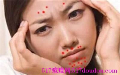 嘴巴周围长痘痘是什么原因？嘴巴周围长痘痘怎么办？