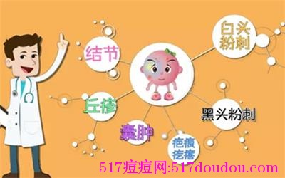 长痤疮的原因哪个更可怕？如何避免走入治痤疮的误区