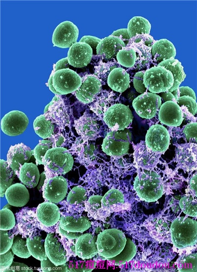 痤疮丙酸杆菌和痘痘有关吗？痤疮丙酸杆菌能导致痘痘吗？
