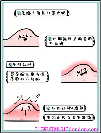 挤完痘痘后怎么处理才是正确的？