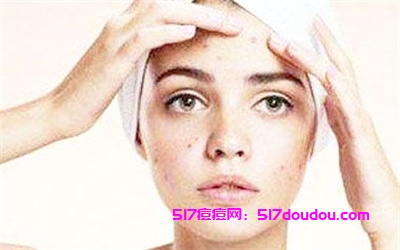 痘痘是什么引起的？