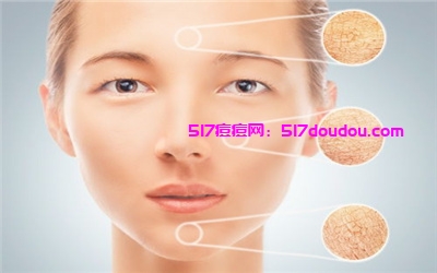 专业去痘印好方法有哪些?