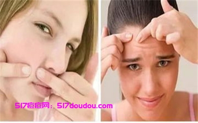 专业去痘印好方法有哪些?