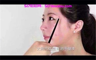 为什么会形成痘印？形成痘印的真正原因