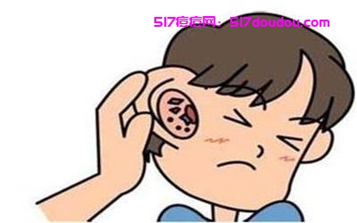 耳朵上长痘痘是什么原因？[长痘原因]